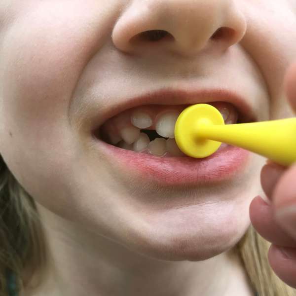 Barn bruger ARK Button Tip – træning af læbelukning og oralmotorisk kontrol

